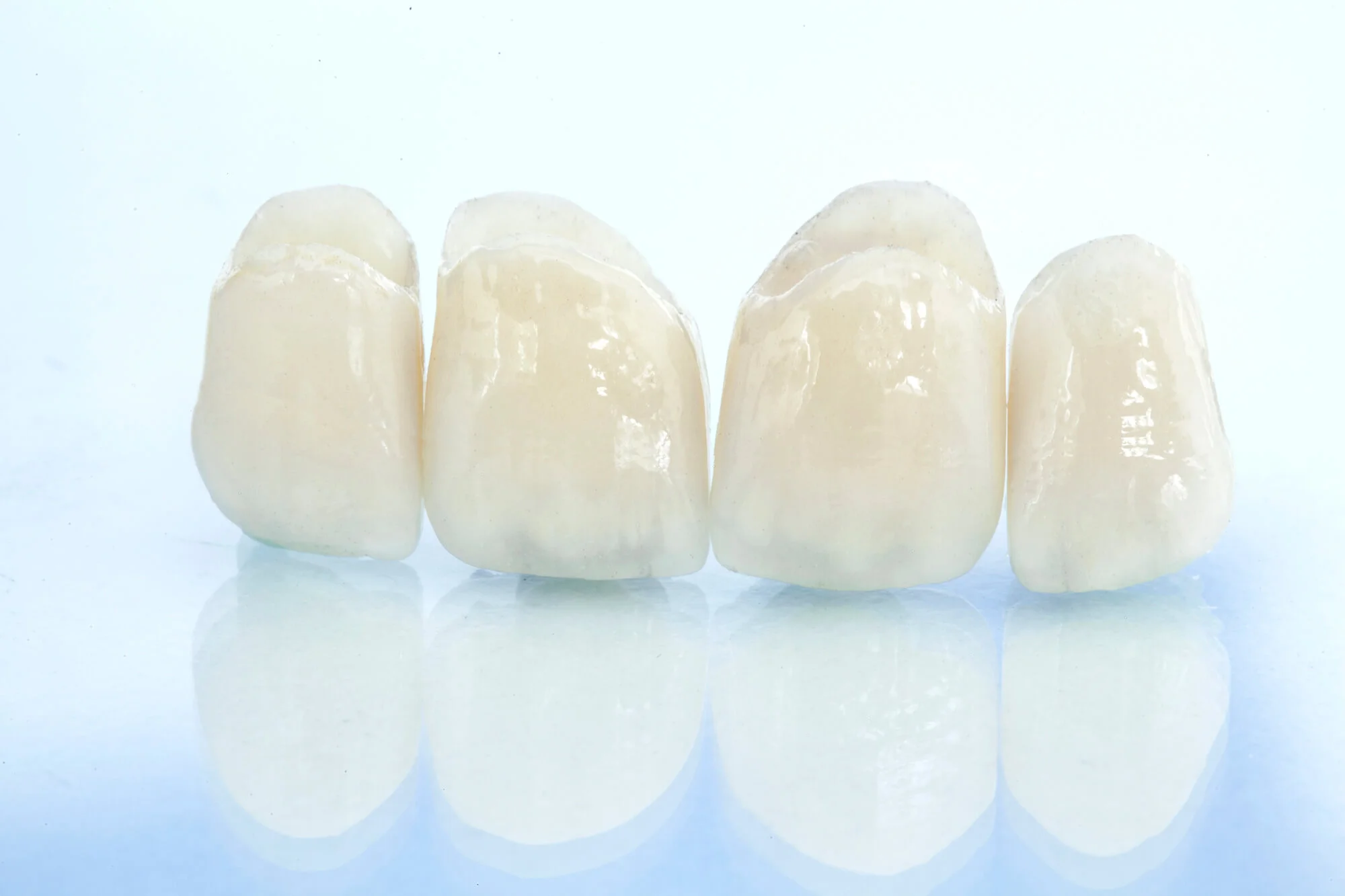 Ceramic dental crowns in Bethesda, with a light blue gradient background.
