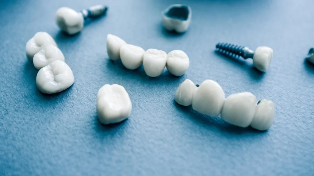 Surgical orthodontics ceramic dental implants in Bethesda
